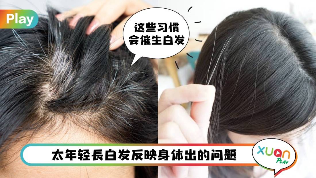 Tips I 几岁长白发才算正常呢？不同年龄段长白发的原因！