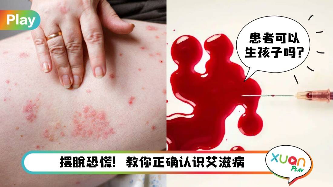 相关信息 I 患上了就死路一条？艾滋病常见5大误区