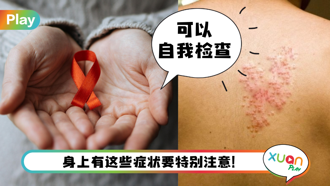 相关信息 I 艾滋病12个早期症状！85%患者都会有这个症状！