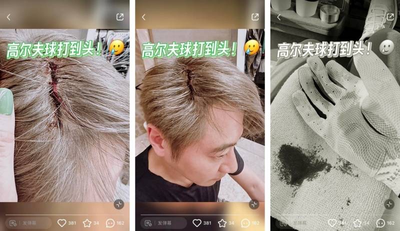 孙耀威被高尔夫球打到头
