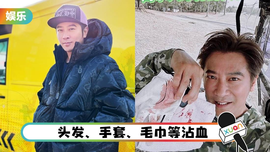 高尔夫球砸中头部！孙耀威球场溅血 伤口达5CM！