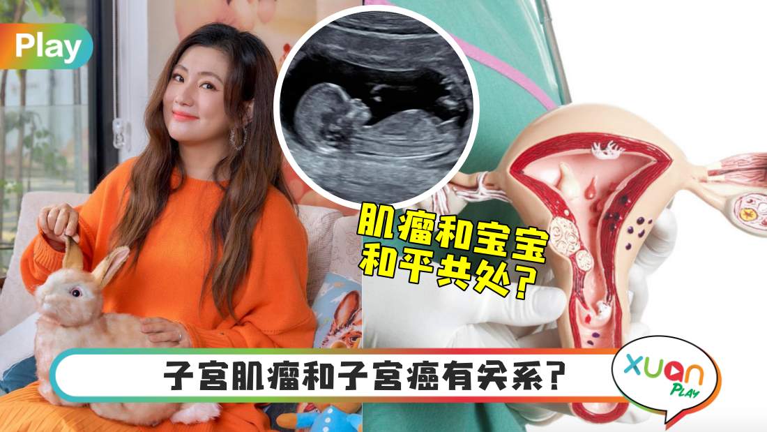 健康I Selina竟能带瘤怀孕？来正确认识子宫肌瘤是什么！