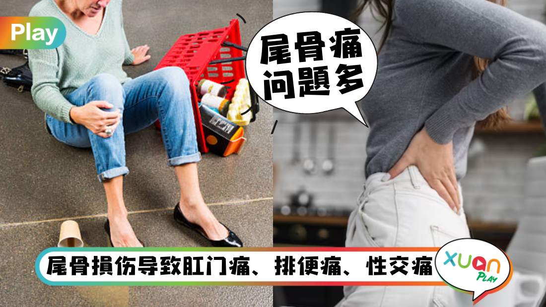 健康I 跌坐在地上不痛就没事？小心尾骨损伤不自知！