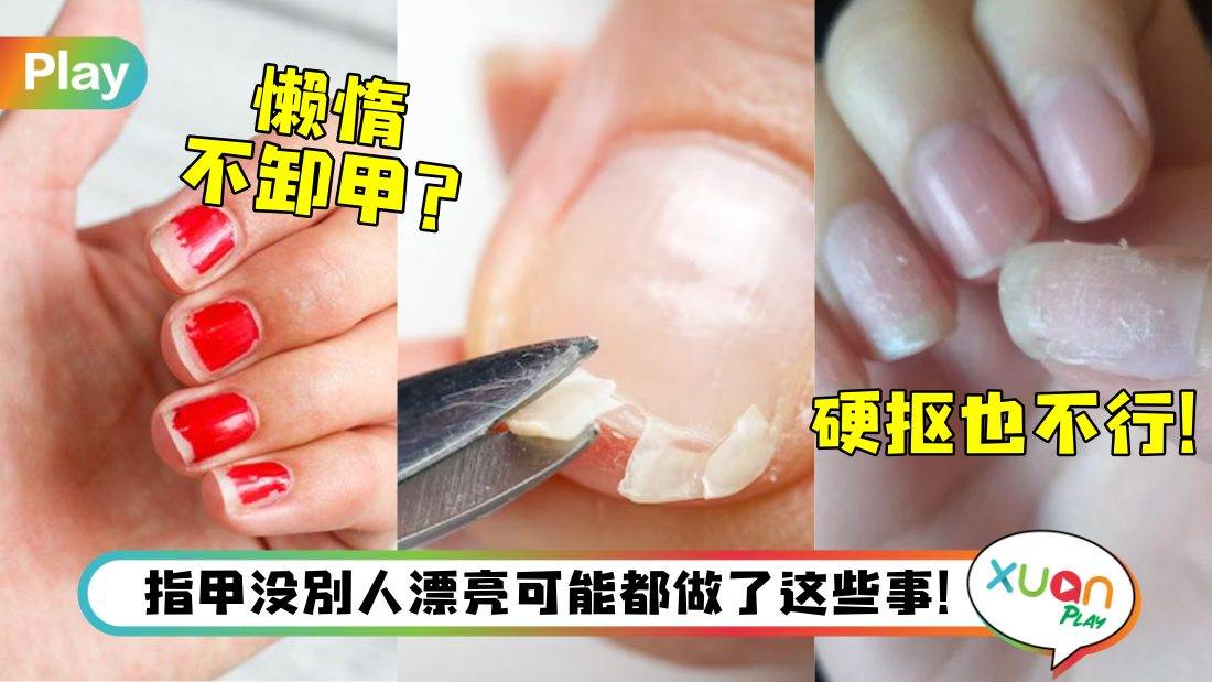 健康I 你的指甲为何比人丑？看来就是做了这5件事！