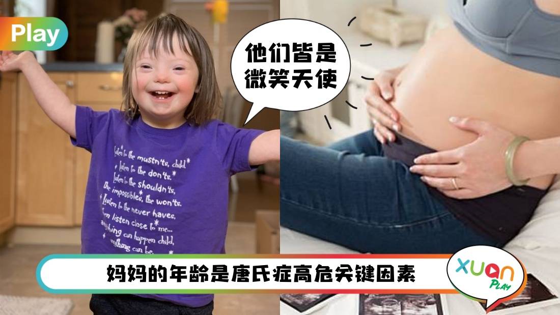健康 I 唐氏综合征不是病而是基因畸变！容易生“唐宝宝”的5类高危人群