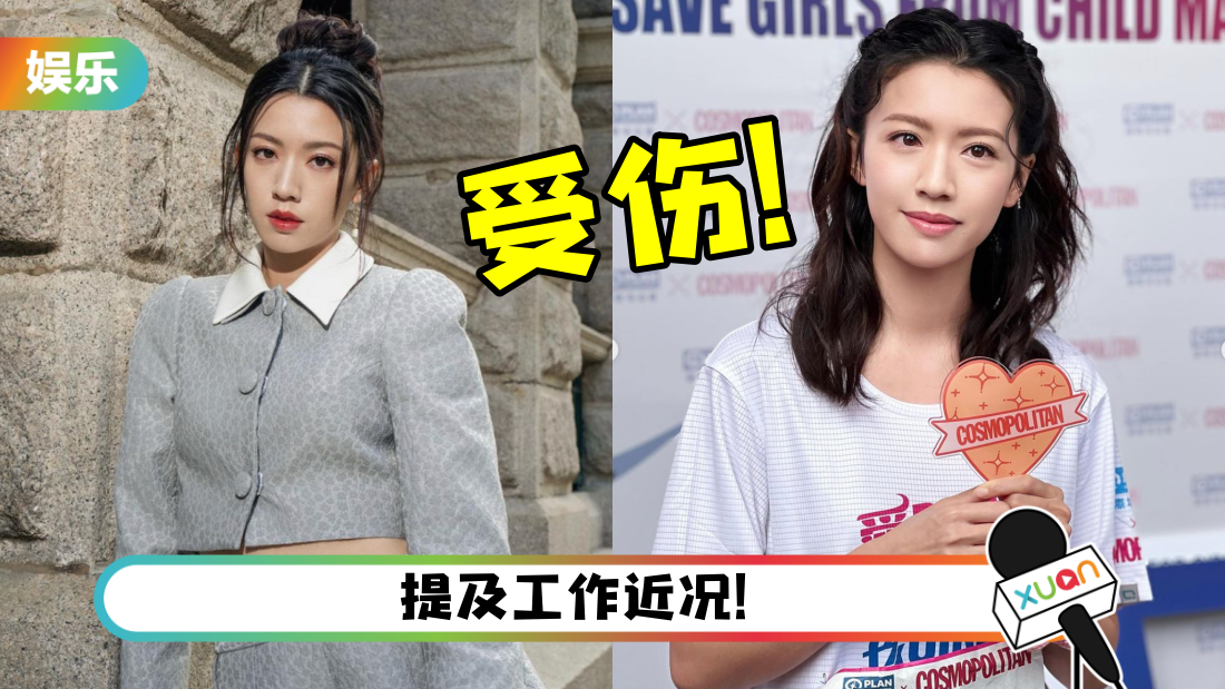 蔡思贝惊爆带伤工作！右眼球惊现“血红色”