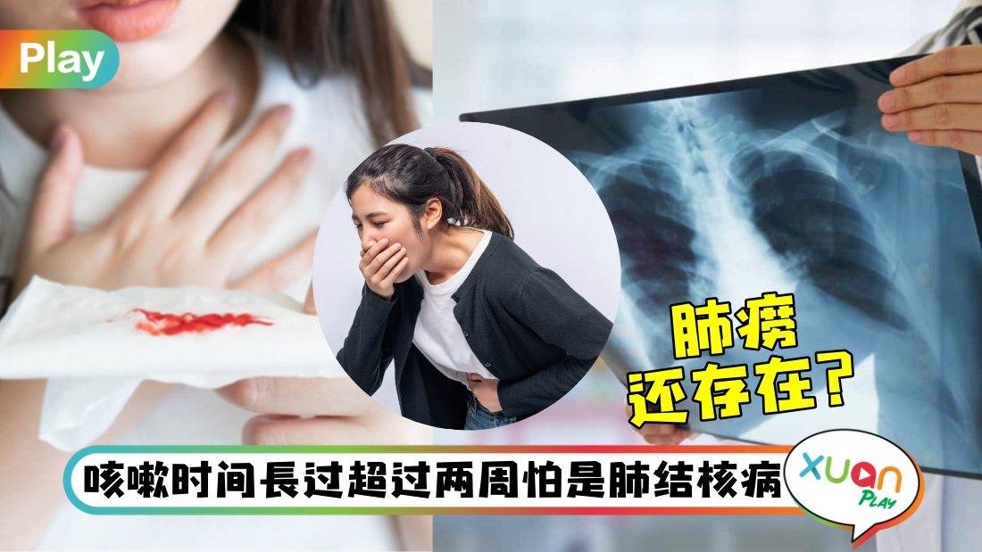 相关信息I 咳嗽两周好不了发现是肺结核！是仅次于新冠的传染性杀手！