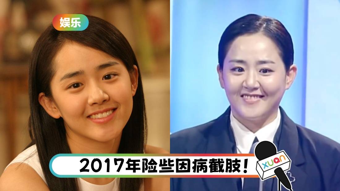 还记得她吗？《蓝色生死恋》 “国民妹妹” 文根英身材变化吓坏粉丝 亲曝原因！