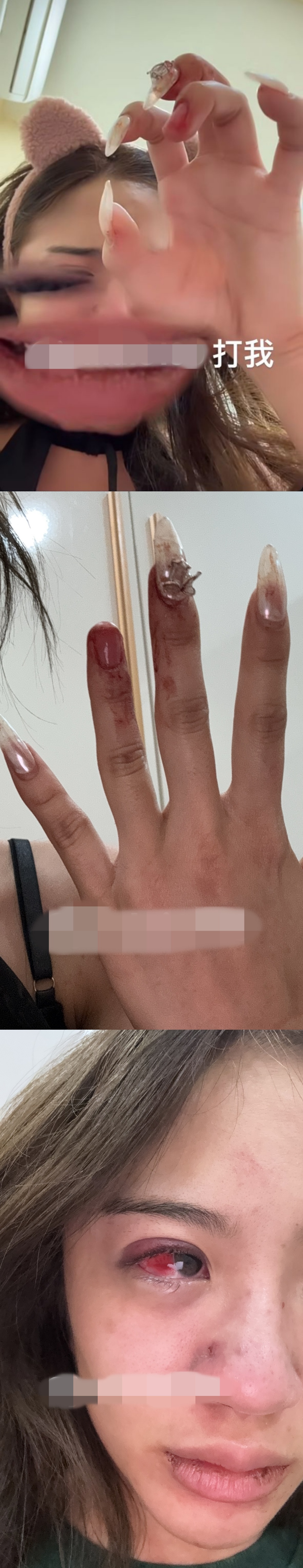 上传被打影片后又删除！Jolyn疑似遭家暴引网讨论 娱乐资讯 图2张