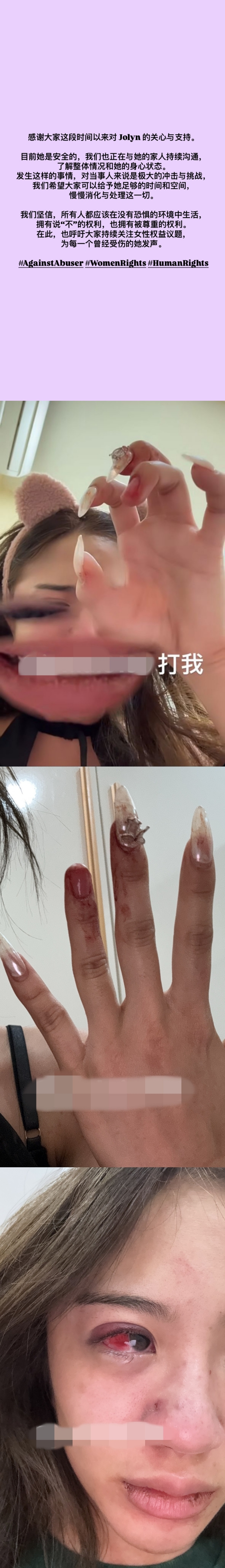 Jolyn曝光现况