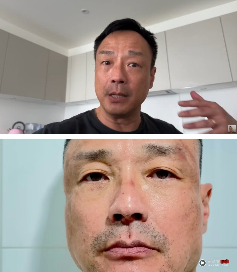 王喜自揭2度被迷奸！醒来后全身赤裸、失禁 娱乐资讯 图2张