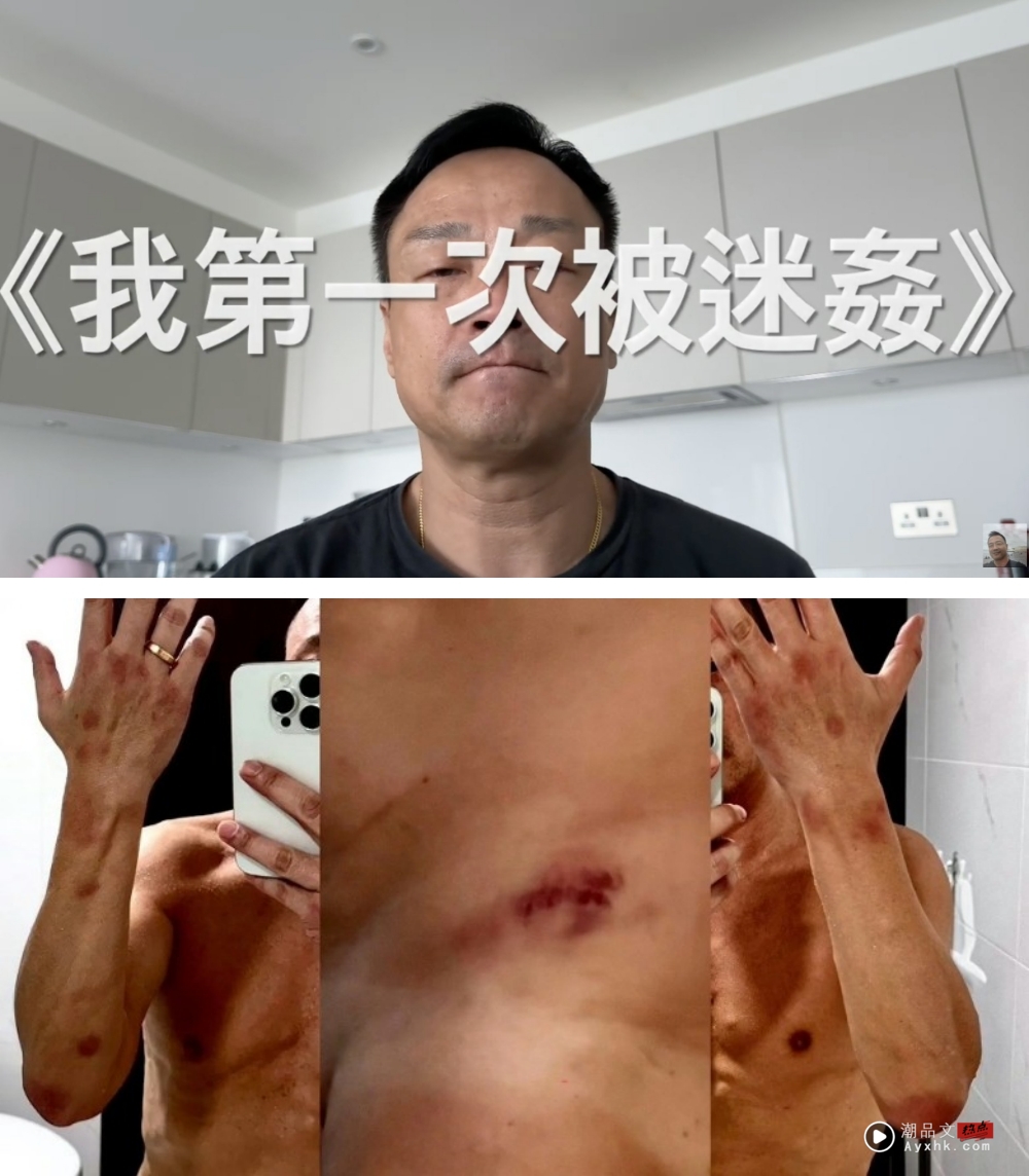 王喜自揭2度被迷奸！醒来后全身赤裸、失禁 娱乐资讯 图1张