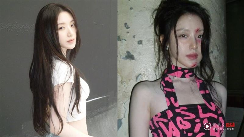 舒华怎么了？无预警晒脸上下巴“全是血伤痕”！吓坏粉疯问：谁打的