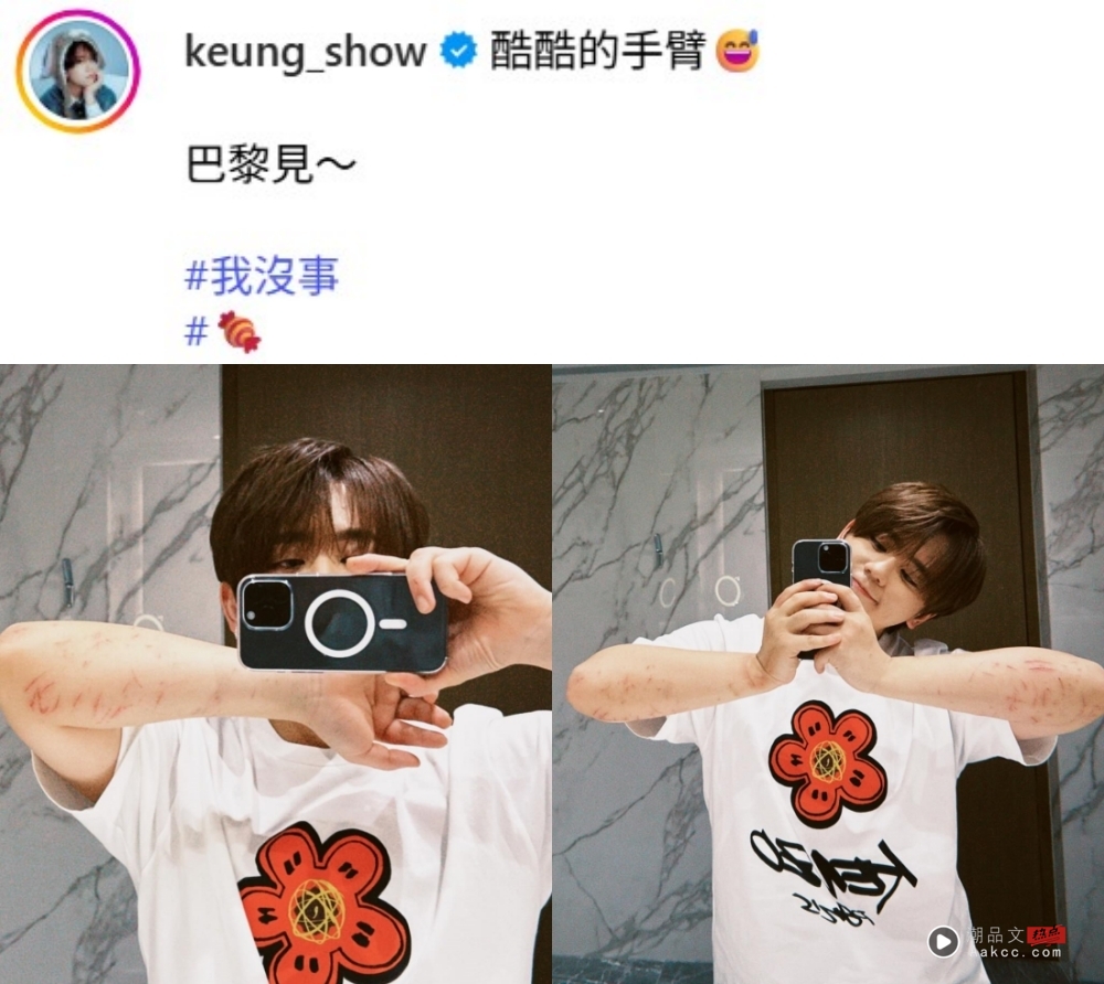 坠海后姜涛首现身！“想告诉大家我没事” 晒双手伤痕照 娱乐资讯 图3张