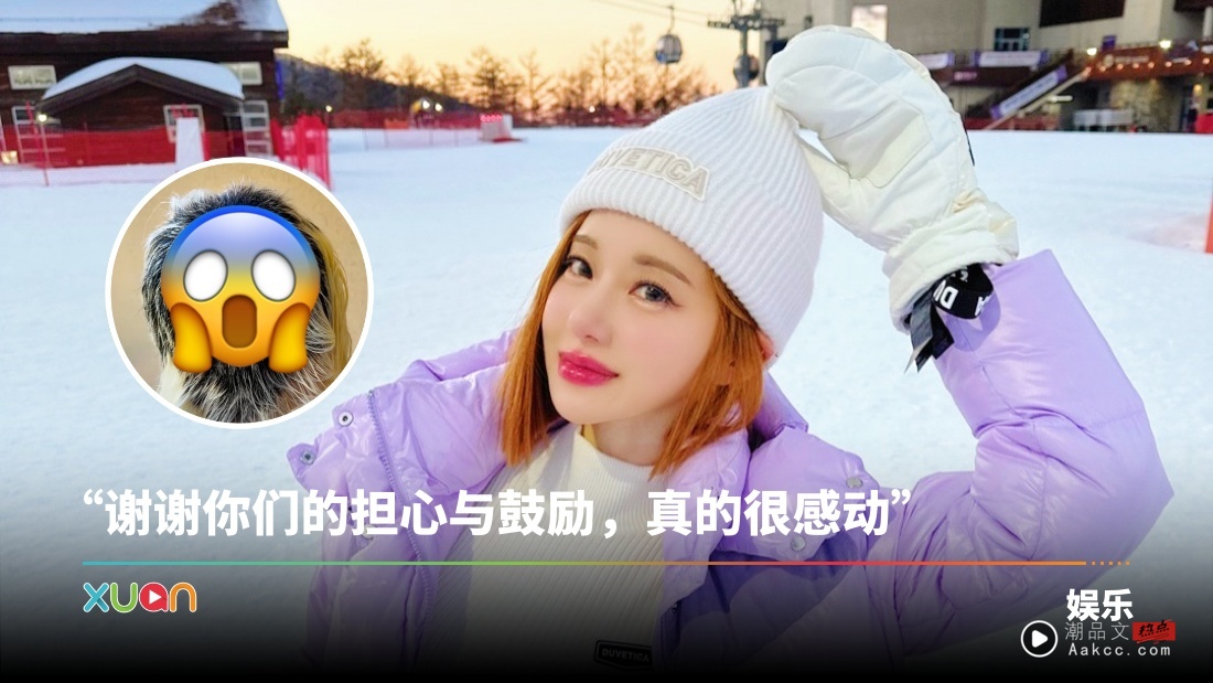 DJ Soda发量只剩10%！奔溃直言：像被虐待的狗狗！