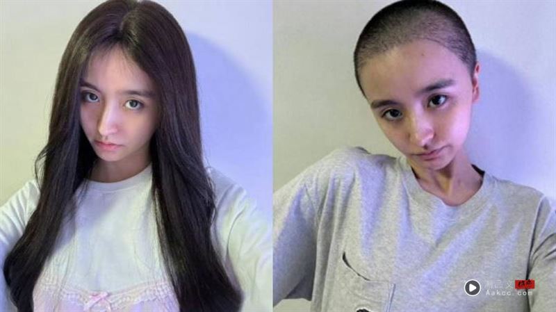 女星突退出演艺圈“突剃光头”！眼神涣散令粉丝担忧　家人露面泄近况