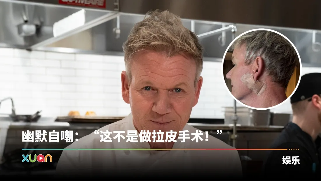 Gordon Ramsay罹患皮肤癌！IG公开术后伤疤！
