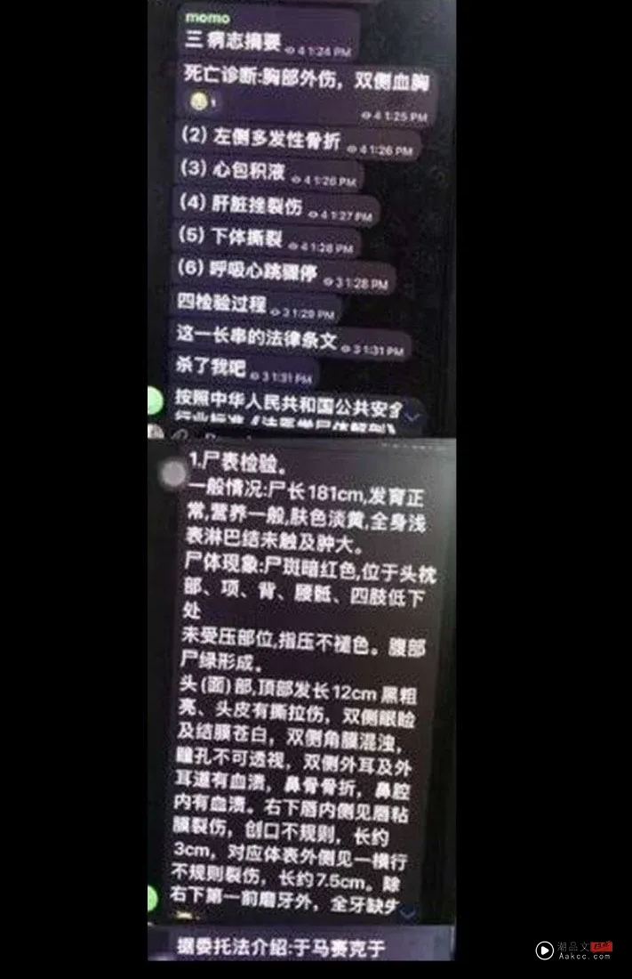 心疼!网疯传于朦胧验尸报告:下体撕裂、全口无牙 内容图4 潮品文-大潮社旗下实时最新热点娱乐时尚数码等新闻资讯网站! 于朦胧