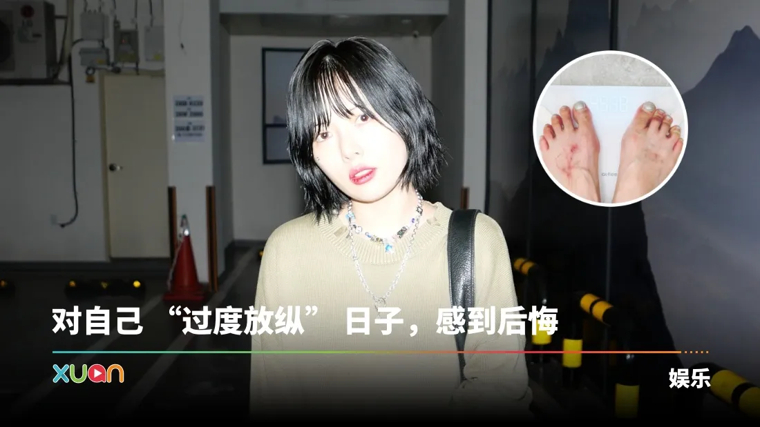 泫雅公开最新体重！脚背全是伤口 亲揭背后原因！