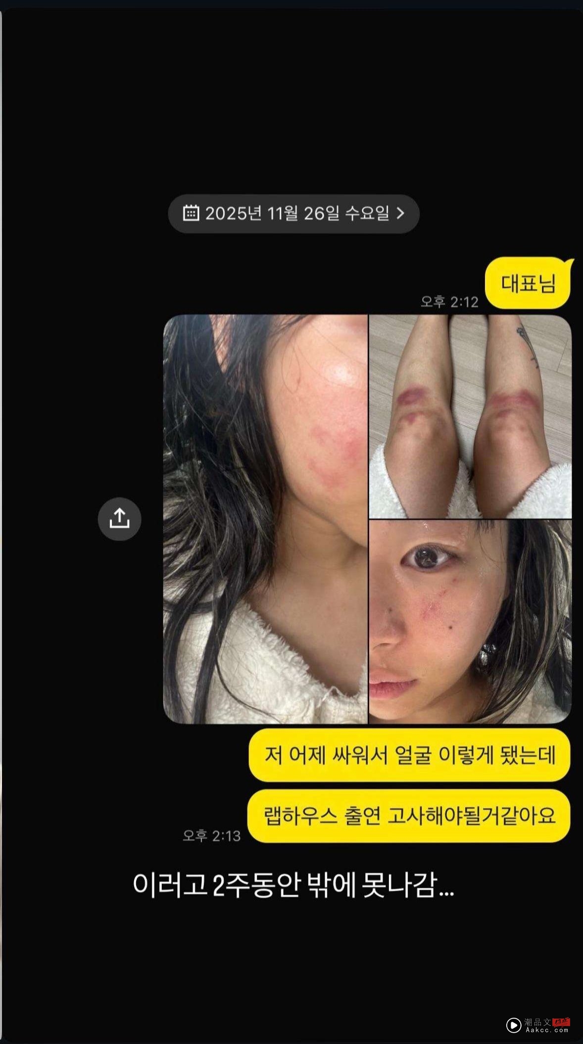 韩国女星控遭前男友软禁掐颈!满身伤痕落泪喊:公开才能结束! 内容图3 潮品文-大潮社旗下实时最新热点娱乐时尚数码等新闻资讯网站! Jvcki Wai