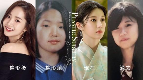 《还魂2》高允贞遭诬陷整容！ 韩星“整形前后对比”，朴敏英最成功，薛仁雅本来就很美