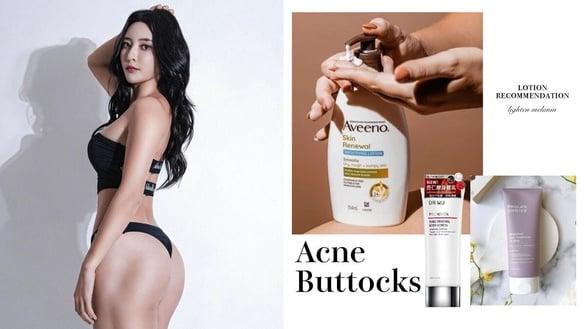 屁股长痘痘怎么消？6招痘痘消除神技：类型&成因、抗痘&消臀痘暗沉保养品推荐
