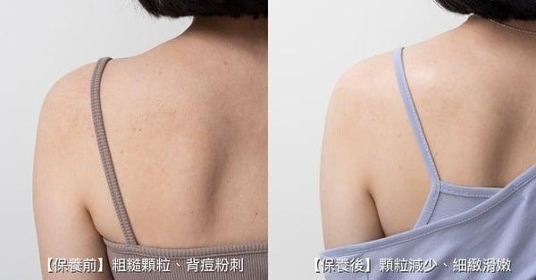入夏焕肤空空赏！网友泪推有感保养品，从脸到身体细嫩透亮，最新二代刷酸7天焕肤抛光 最新 图2张