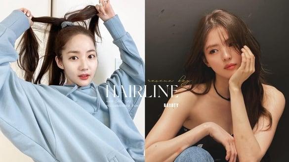 发际线后退怎么办？“发际线养发”技巧公开！避免换季狂掉发、发际线越来越秃