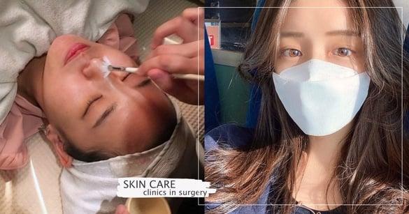 农历年前“零恢复期”医美推荐！斑点、暗沉、毛孔最佳雷射，术后还可秒上妆