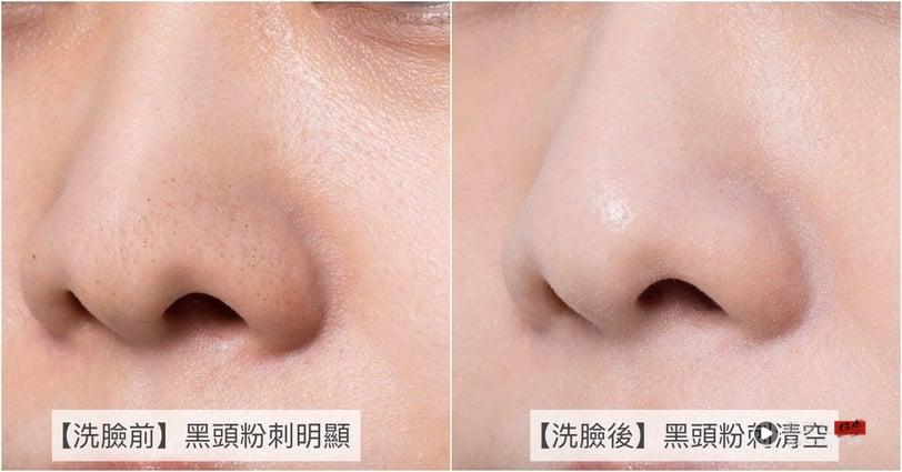 粉刺肌泪推！ORBIS热卖王“双重酵素洁颜粉”洗完毛孔清爽洁净，肌肤嫩过水煮蛋！ 最新 图1张