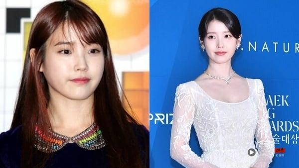 IVE Liz 瘦身成果太惊人！9位韩星“减肥前后”对比：IU、T.O.P、GD 都曾肉嘟嘟！ 娱乐 图17张