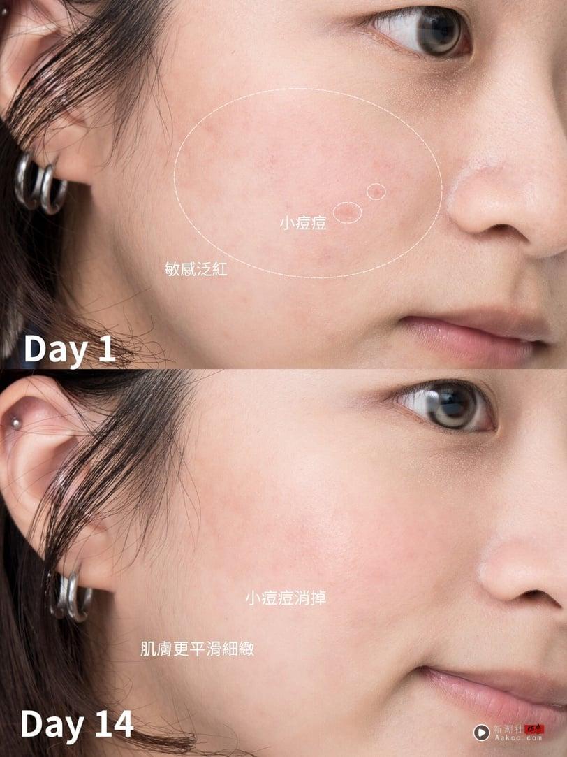 Lily皮肤为什么这么好？修护保湿少不了急救小粉瓶，敏感肌养成水光肌推荐好物公开！