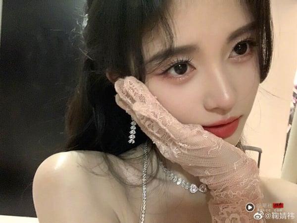 《许我耀眼》赵露思遭疑整形？7位被怀疑动脸的电视剧女星，《柳舟记》王楚然也变美了！ 娱乐 图8张