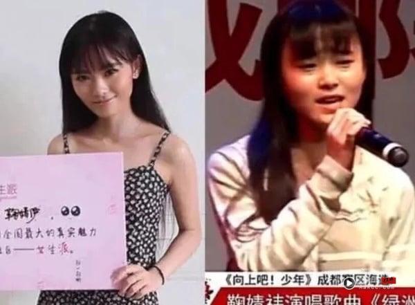 《许我耀眼》赵露思遭疑整形？7位被怀疑动脸的电视剧女星，《柳舟记》王楚然也变美了！ 娱乐 图7张