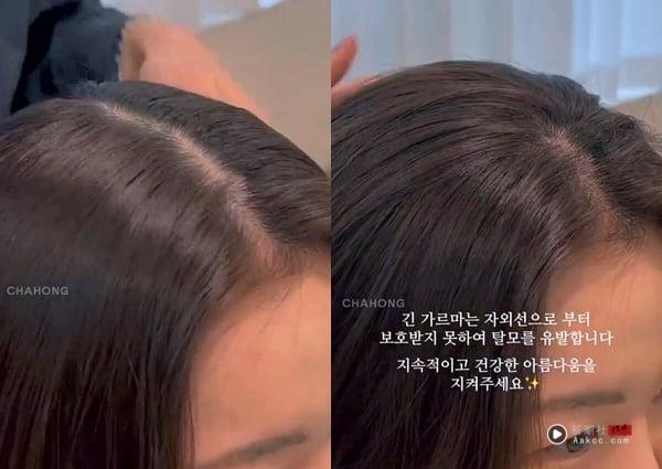 发缝大、分线秃怎么办？6款修饰发际线浏海＋分线整理技巧一次看，视觉丰盈发量不稀疏 最新 图1张