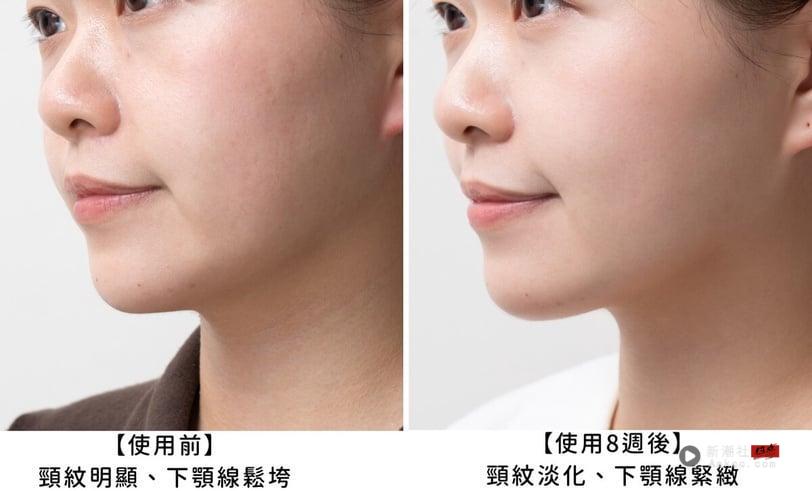 NEXT LEVEL玻尿酸新纪元!理肤宝水首创“修复型玻尿酸”继医美机转3倍渗透减81%深层纹! 最新 图6张