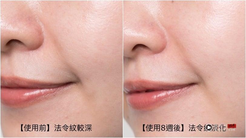 NEXT LEVEL玻尿酸新纪元!理肤宝水首创“修复型玻尿酸”继医美机转3倍渗透减81%深层纹! 最新 图5张