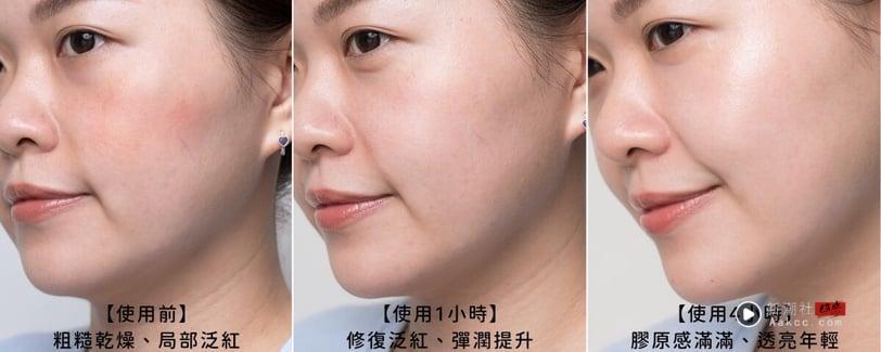 NEXT LEVEL玻尿酸新纪元!理肤宝水首创“修复型玻尿酸”继医美机转3倍渗透减81%深层纹! 最新 图4张