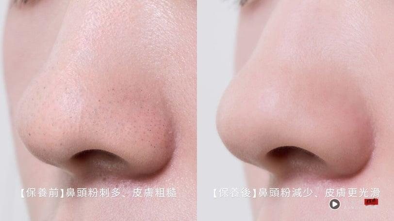 夏天油痘大爆发？清洁后第一步交给宝拉珍选，找到你的命定水杨酸，守护肌肤的和平！
