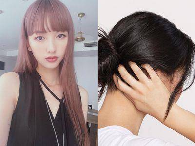 油头、敏感或掉发都有解！专家教“头皮3大问题”改善法