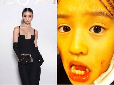 木村光希20岁生日乐收LV珠宝盒　女神竟被妈妈出卖缺牙爆血照