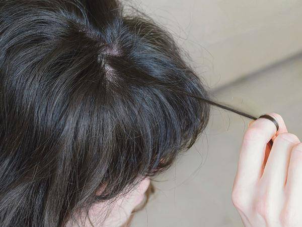 皮肤科医师：不自觉拔头发恐是“拔毛症”，3款养发精华急救推荐 最新资讯 图1张