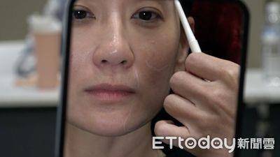 席卷全球的童妍针全面升级　打造精品级颜质　让你自带光环