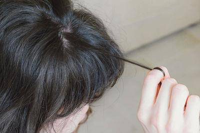 落发年纪下修！“30岁最有感”发际线后移，5成民众自觉发量不足