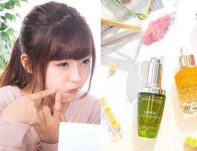 约会前急救恼人痘痘！4款抗痘救星 　小绿瓶、汉方草本消退有感