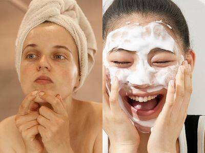 下巴痘反复长原因及改善方法详解！8款抗痘神品　阿嬷级化妆水激推