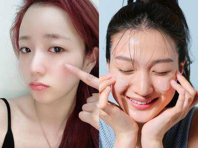 痘痘冒不停？皮肤科医师揭“3个保养坏习惯”让痘痘更严重