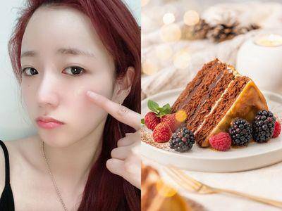 皮肤科医师揭3个“加重痘痘”的生活习惯：睡眠不足大NG