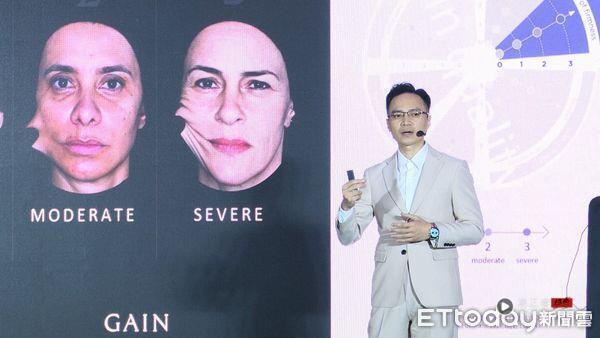 4D童妍针推出“肌肤再生之钥”疗程自由搭配 精准客制化美丽 最新资讯 图5张