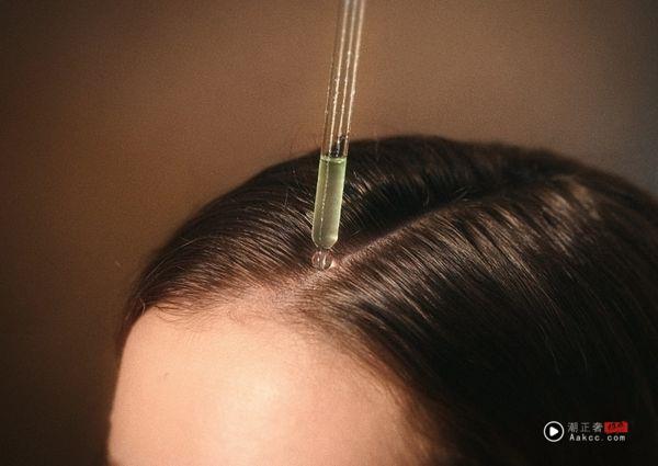 用错等于白擦！养发头皮精华4个重点必看　这样才有效 最新资讯 图1张